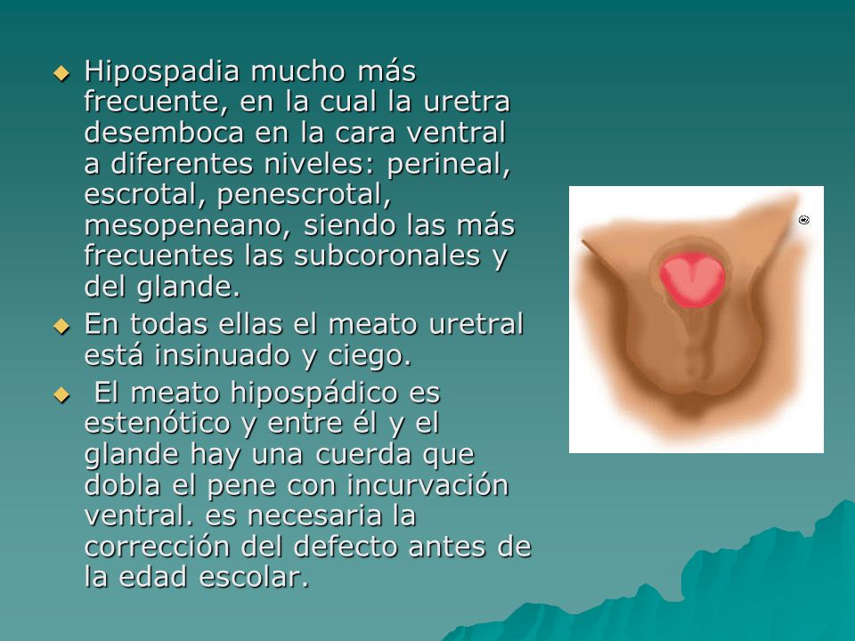 Las pastillas para el aumento del miembro de hombre
